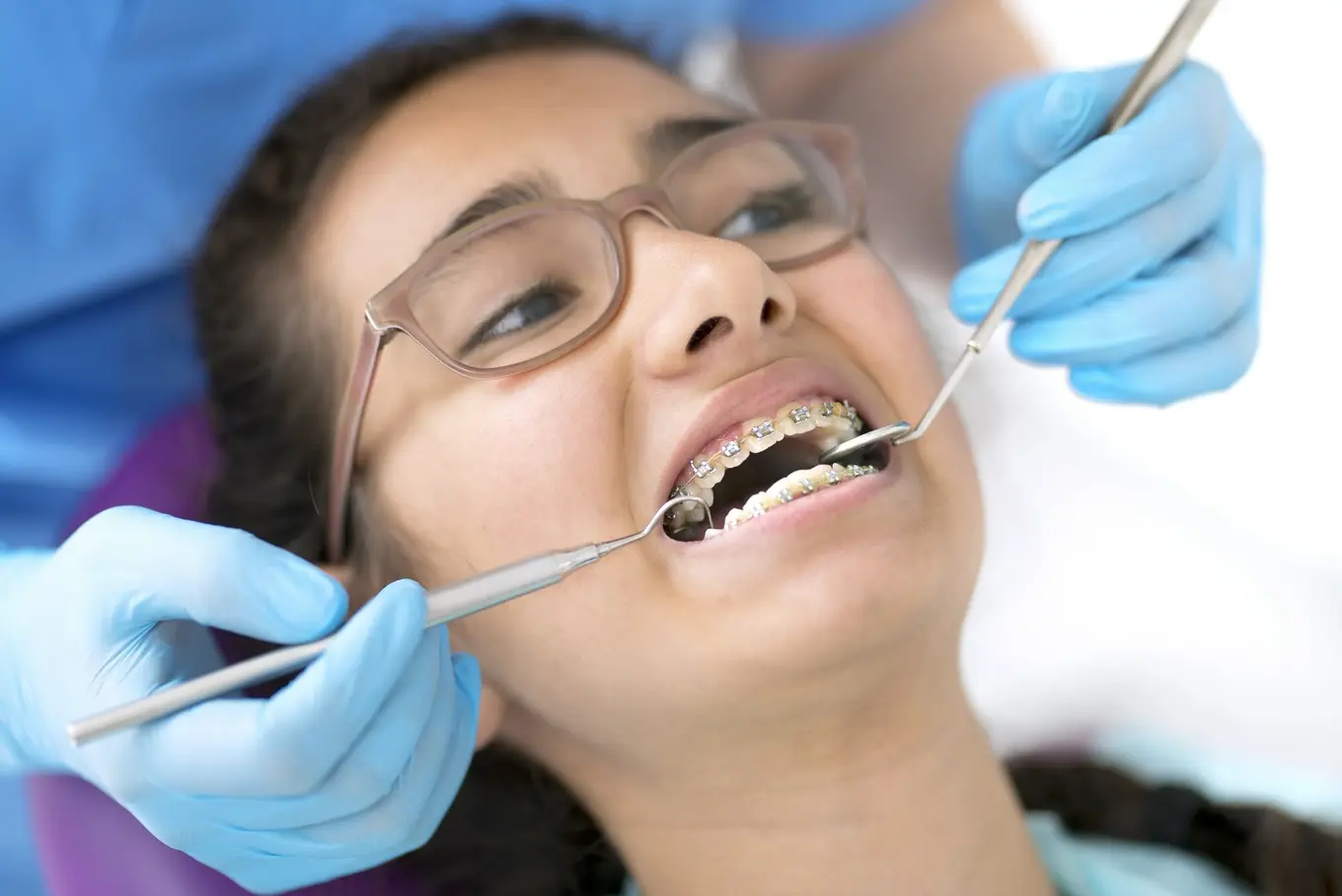 kobieta z aparatem na fotelu dentystycznym